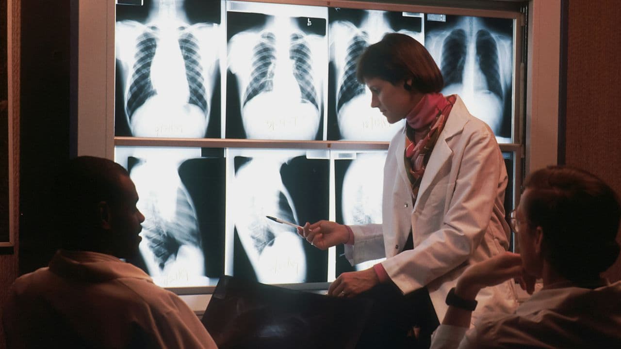 Equipo médico analizando radiografías